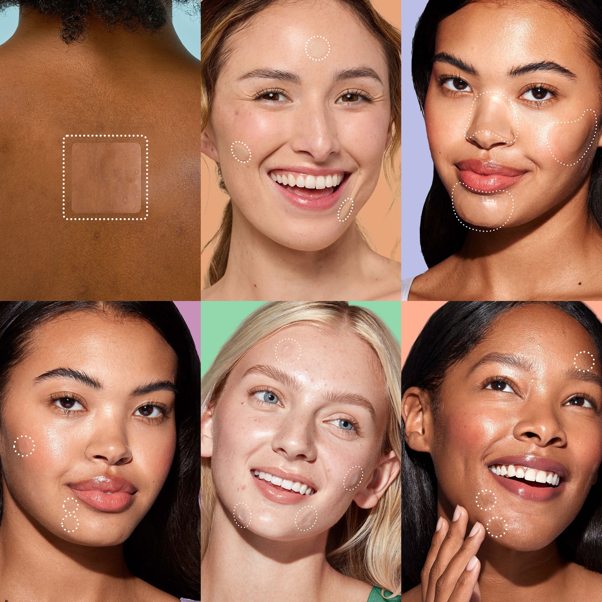 Miracle Patch Ultimate Pimple Patch Kit
